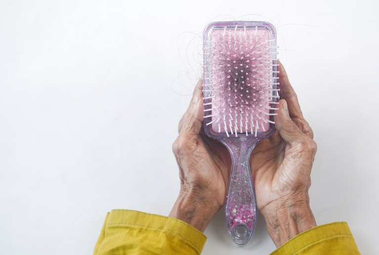 hair loss